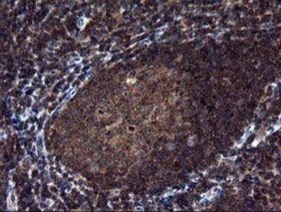 Immunohistochemistry: NEK11 Antibody (OTI5D9) [NBP2-46140]