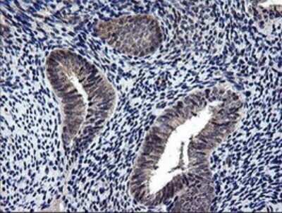 Immunohistochemistry: NEK11 Antibody (OTI5D9) [NBP2-46140]