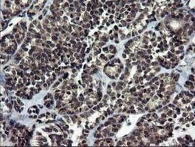 Immunohistochemistry: NEK11 Antibody (OTI5D9) [NBP2-46140]