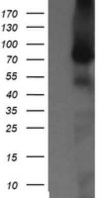 Western Blot: NEK11 Antibody (OTI5D9) [NBP2-46140]