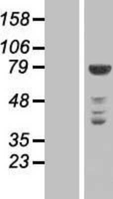 Western Blot: NEK11 Overexpression Lysate [NBP2-06284]