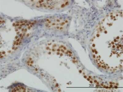 Immunohistochemistry-Paraffin: NEK2 Antibody (2F6) [H00004751-M01]