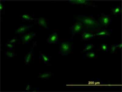 Immunocytochemistry/ Immunofluorescence: NEK2 Antibody (2F9) [H00004751-M02]