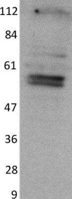 Western Blot: NEK2 Antibody (2F9) [H00004751-M02]