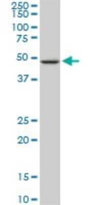 Western Blot: NEK2 Antibody (3B7) [H00004751-M11]