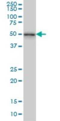 Western Blot: NEK2 Antibody (3B7) [H00004751-M11]