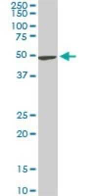 Western Blot: NEK2 Antibody (3B7) [H00004751-M11]