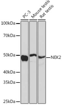 Western Blot: NEK2 Antibody (5O0A1) [NBP3-16641]