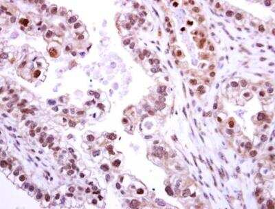 Immunohistochemistry-Paraffin: NEK2 Antibody [NBP2-19510]