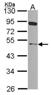 Western Blot: NEK2 Antibody [NBP2-19510]