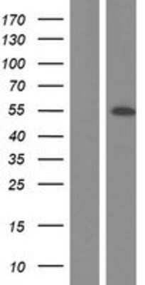 Western Blot: NEK2 Overexpression Lysate [NBP2-08109]