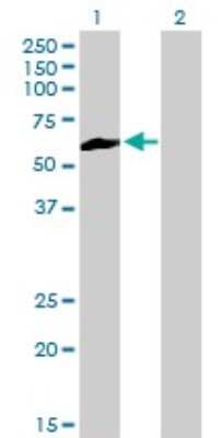 Western Blot: NEK3 Antibody (2F8) [H00004752-M01]