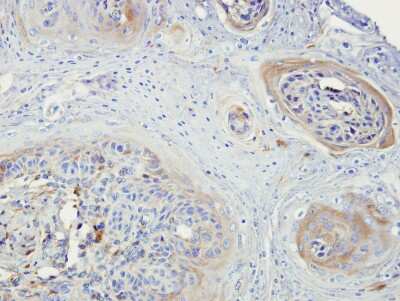 Immunohistochemistry-Paraffin: NEK3 Antibody [NBP1-32624]