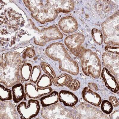 Immunohistochemistry-Paraffin: NEK3 Antibody [NBP2-13649]