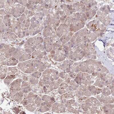 Immunohistochemistry-Paraffin: NEK3 Antibody [NBP2-13650]