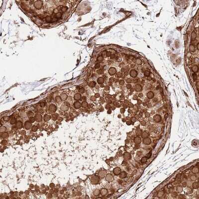Immunohistochemistry-Paraffin: NEK3 Antibody [NBP2-13650]