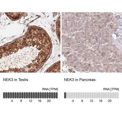 Immunohistochemistry-Paraffin: NEK3 Antibody [NBP2-13650]