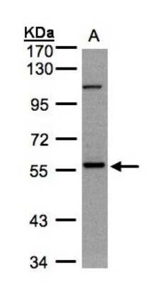 Western Blot: NEK3 Antibody [NBP1-32624]