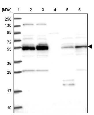 Western Blot: NEK3 Antibody [NBP2-13650]