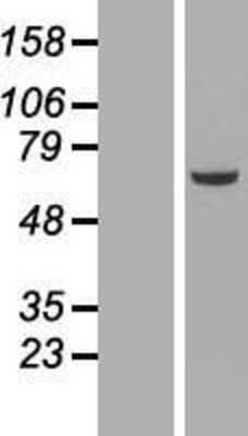 Western Blot: NEK3 Overexpression Lysate [NBL1-13584]