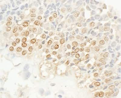 Immunohistochemistry: NEK4 Antibody [NBP1-42686]