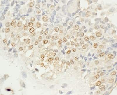Immunohistochemistry: NEK4 Antibody [NBP1-42687]
