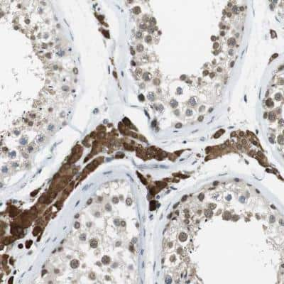 Immunohistochemistry-Paraffin: NEK4 Antibody [NBP1-82528]