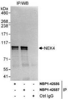 Immunoprecipitation: NEK4 Antibody [NBP1-42686]