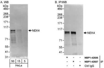 Western Blot: NEK4 Antibody [NBP1-42687]