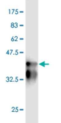 Western Blot: NEK5 Antibody (2F1) [H00341676-M01]