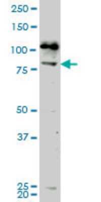 Western Blot: NEK5 Antibody (7G2) [H00341676-M02]