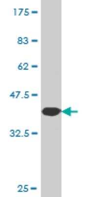 Western Blot: NEK5 Antibody (7G2) [H00341676-M02]