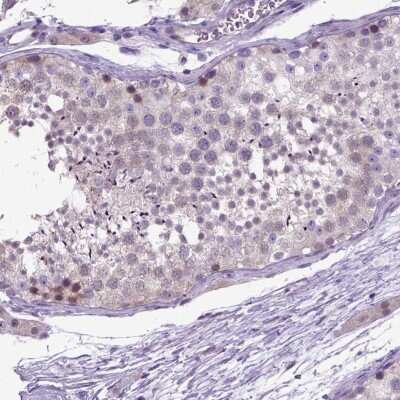 Immunohistochemistry: NEK5 Antibody [NBP2-48737]