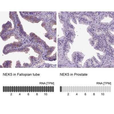 Immunohistochemistry-Paraffin: NEK5 Antibody [NBP1-85903]