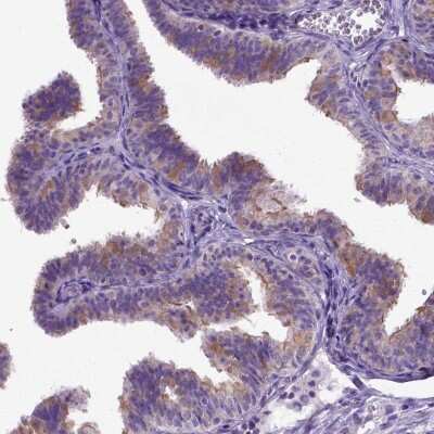 Immunohistochemistry-Paraffin: NEK5 Antibody [NBP2-48737]