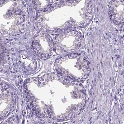 Immunohistochemistry-Paraffin: NEK5 Antibody [NBP2-48737]