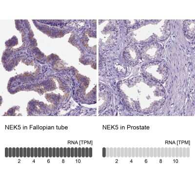 Immunohistochemistry-Paraffin: NEK5 Antibody [NBP2-48737]