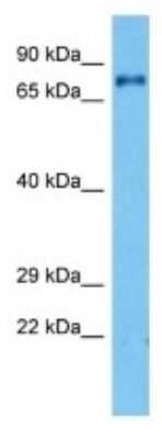 Western Blot: NEK5 Antibody [NBP3-10180]