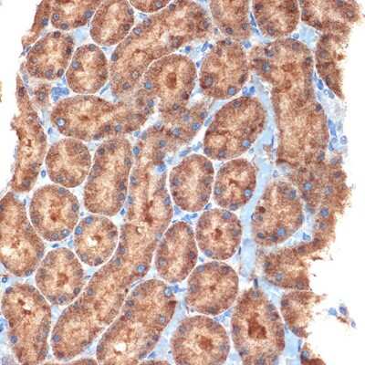 Immunohistochemistry-Paraffin: NEK6 Antibody (1V1X8) [NBP3-16215]