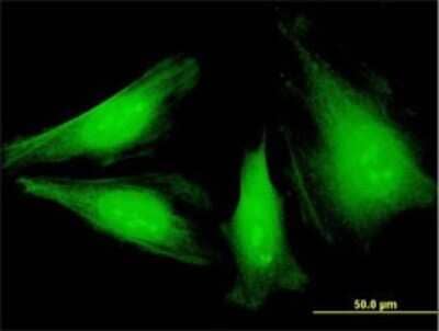 Immunocytochemistry/ Immunofluorescence: NEK6 Antibody (3B5) [H00010783-M01]