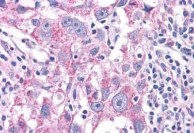 Immunohistochemistry: NEK6 Antibody [NBP3-14415]