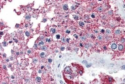 Immunohistochemistry-Paraffin: NEK6 Antibody [NBP3-14415]