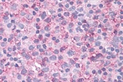 Immunohistochemistry-Paraffin: NEK6 Antibody [NBP3-14415]