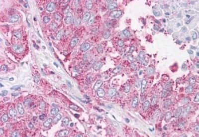 Immunohistochemistry-Paraffin: NEK6 Antibody [NBP3-14415]