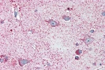 Immunohistochemistry-Paraffin: NEK6 Antibody [NBP3-14415]