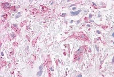 Immunohistochemistry-Paraffin: NEK6 Antibody [NBP3-14415]