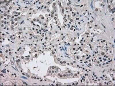 Immunohistochemistry: NEK6 Antibody (OTI5D7) - Azide and BSA Free [NBP2-72938]
