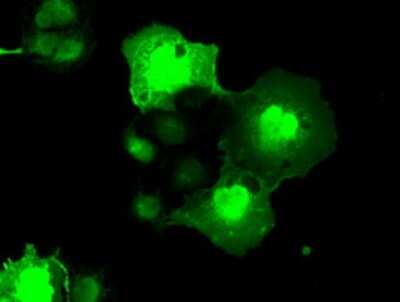 Immunocytochemistry/ Immunofluorescence: NEK6 Antibody (OTI5D7) [NBP1-47865]