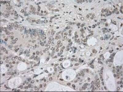 Immunohistochemistry-Paraffin: NEK6 Antibody (OTI5D7) [NBP1-47865]