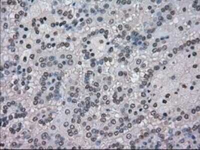 Immunohistochemistry-Paraffin: NEK6 Antibody (OTI5D7) [NBP1-47865]